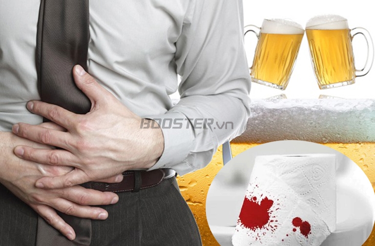 Hút thuốc lá và uống nhiều bia rượu sẽ gây đau cột sống dưới mông