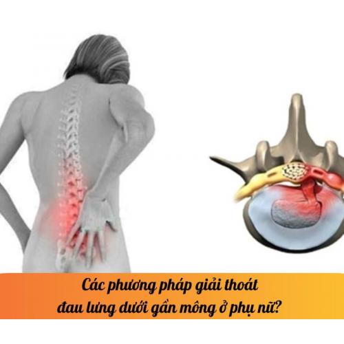 Các phương pháp giải thoát đau lưng dưới gần mông ở phụ nữ? 